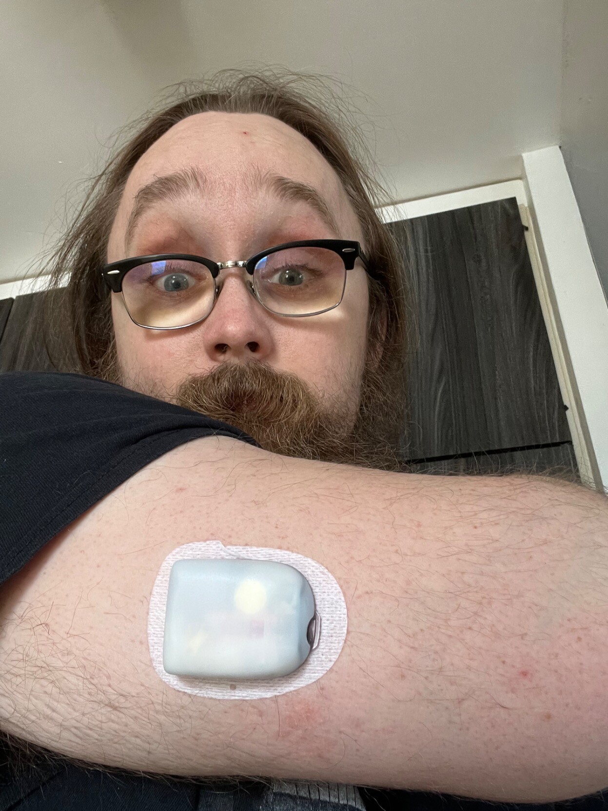 Naamakuva itsestäni. Kuvassa näkyy mun oikea olkavarteni, jossa roikkuu pieni valkoinen säiliö täynnä insuliinia